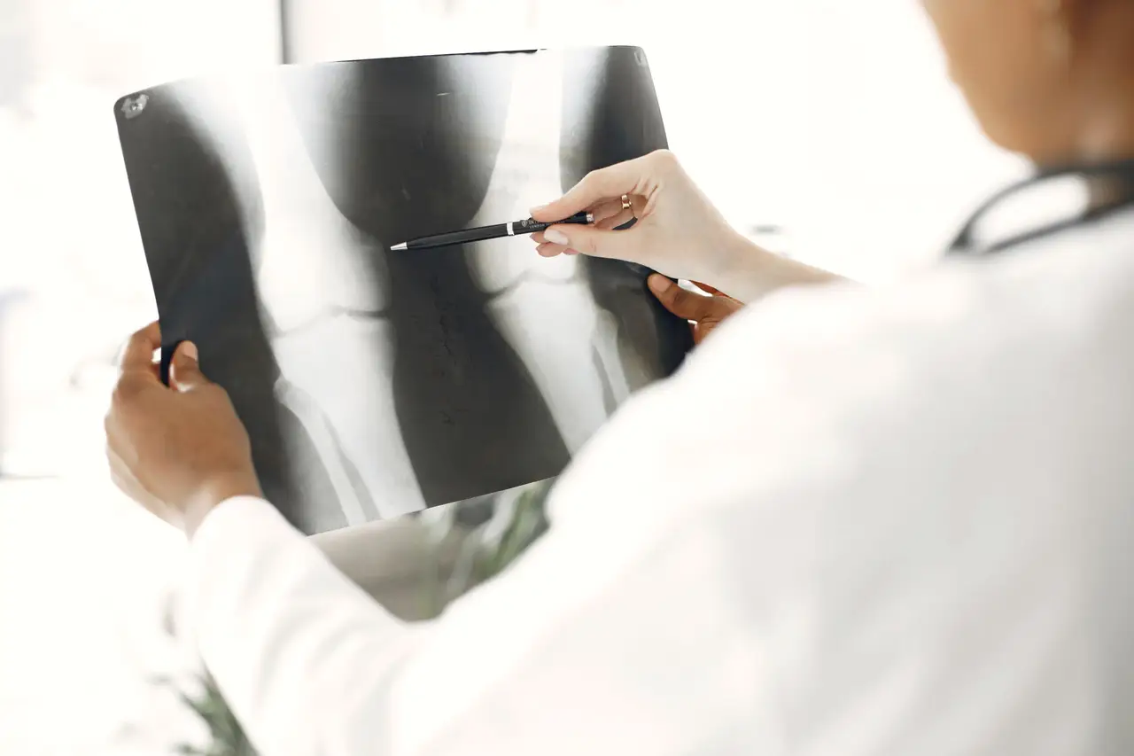 Doctor Looking at Legs Roentgen